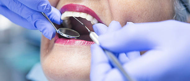 Best Emergency Gum Treatment in Jonesboro, LA
